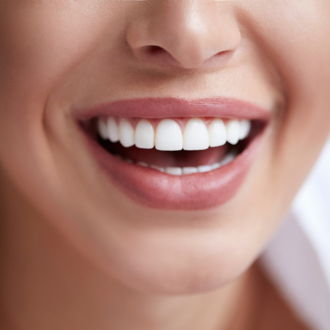 Efectele albirii dentare